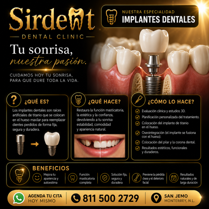 Implantes dentales